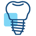 Implantes Dentários